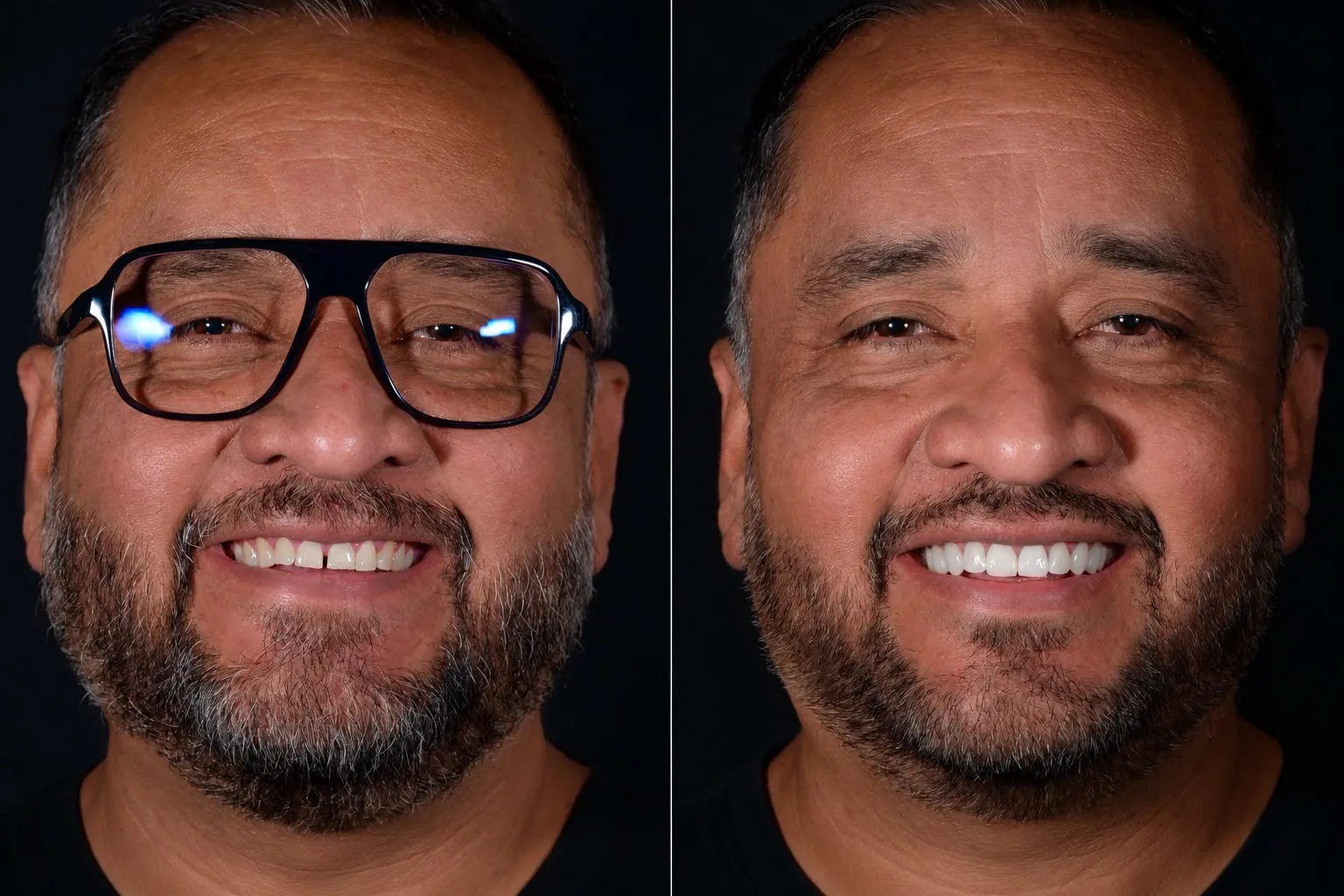 Resultado de estética dental