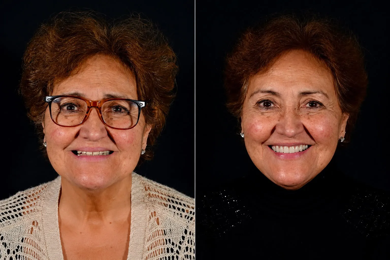Resultado de rehabilitación oral
